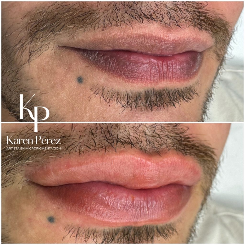 Micropigmentación labios maquillaje semipermanente forma natural color hombre Karen Pérez